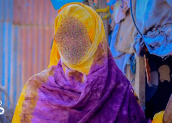 Kismaayo: Qoysas la nool cudurka HIV AIDS oo wajahaya cunno yari iyo waxbarasho la’aan